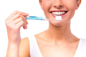 A close-up view of a young woman about to brush her teeth with braces with a blue toothbrush. She is smiling in the photo.