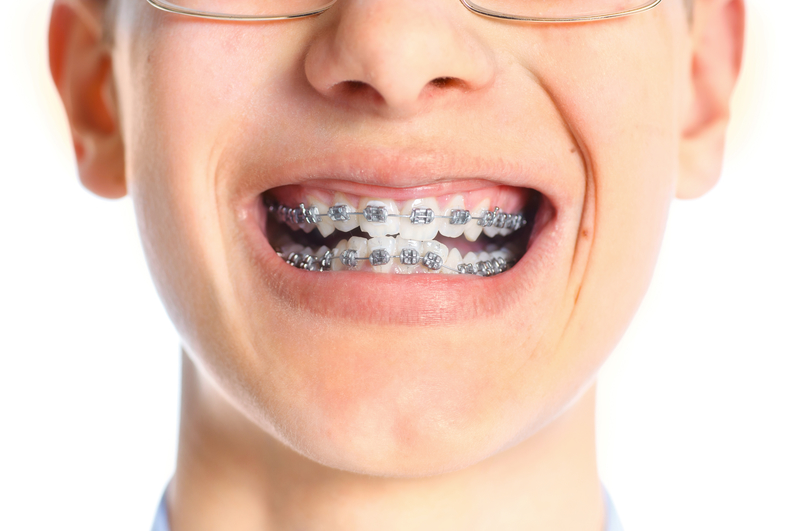 close-up view of a boy's braces