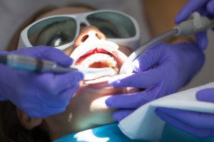 Patient receiving a laser dentistry procedure.