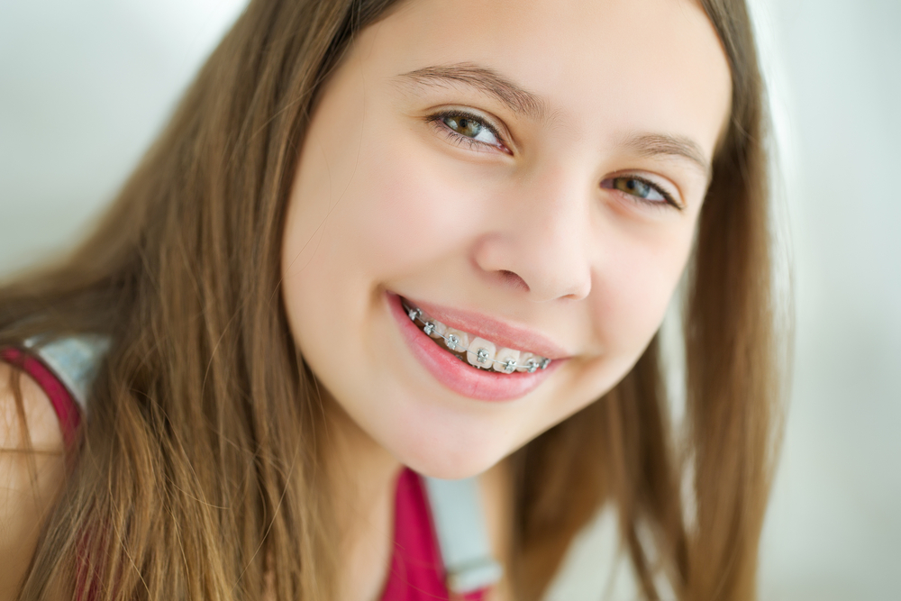 orthodontic treatment phases