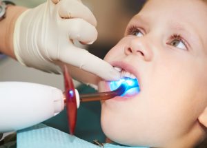 A young boy that is having his dental fillings finished with a dental light.