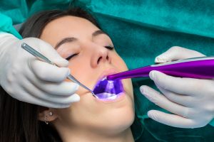 Close up of dentist working on patient's teeth with blue led curing light