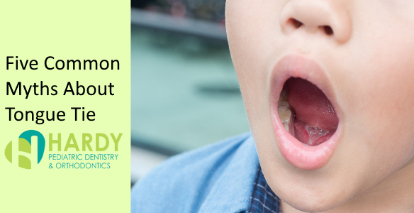Five Common Myths About Tongue/Lip Ties - Hardy Pediatric Dentistry &  Orthodontics